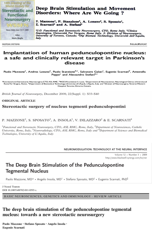 neuromodulation2